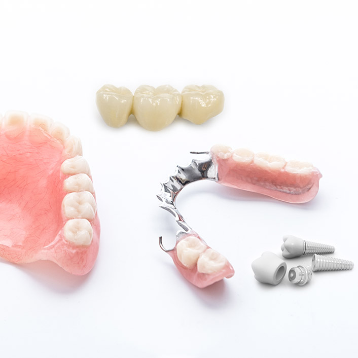Implants vs Dentures and Bridges