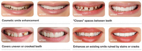 Take a look at what Snap on Smile can do!