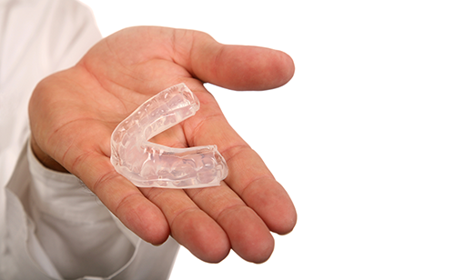 Mouth Guards - Loop Chicago Dentist - Chicago IL