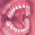 Dentures - The Dental Practice of Lincoln Park - Chicago, IL