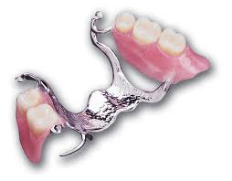 metal base denture