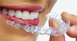 Cosmetic Dentist & Aligners - Brentwood, TN