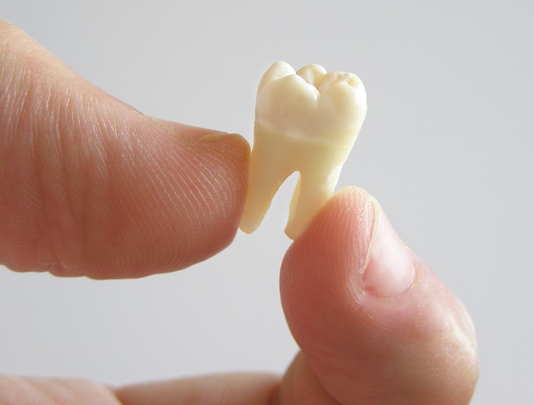 person's thumb and forefinger holding molar tooth, tooth extractions Narberth, PA dentist