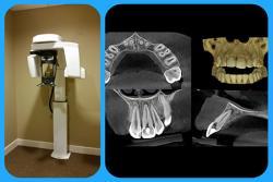 3D Dental Imaging in Buford, GA