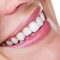 woman's mouth smiling white straight teeth, cosmetic dental bonding Melrose, MA dentist