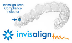 logo for Invisalign Teen, clear aligner tray with blue dot showing compliance indicator, Invisalign Melrose orthodontics