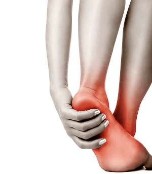 Plantar Fasciitis in Hamden, CT