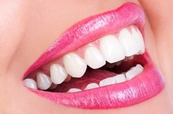 Teeth Whitening | Roscoe, IL