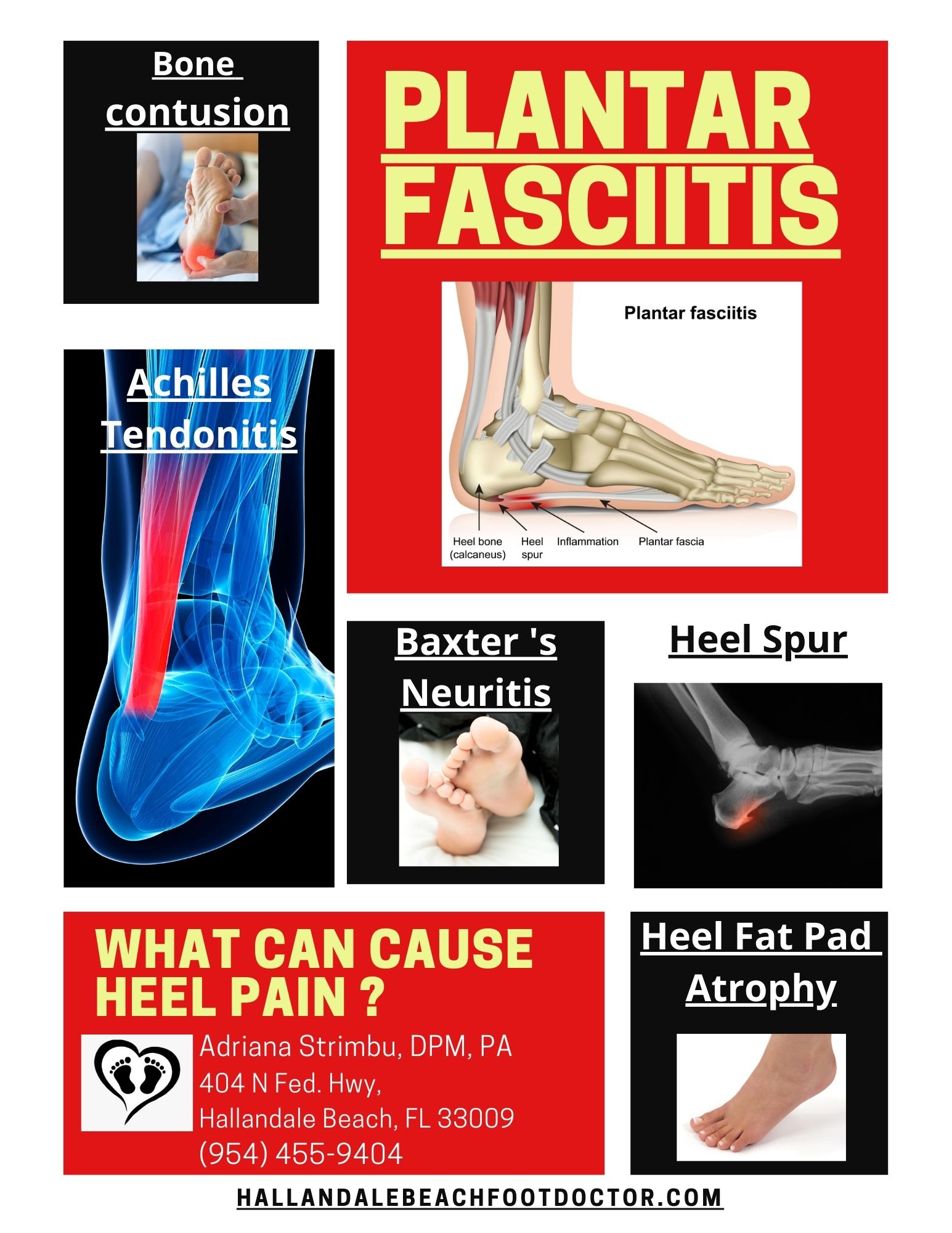 What Can Cause Heel Pain?