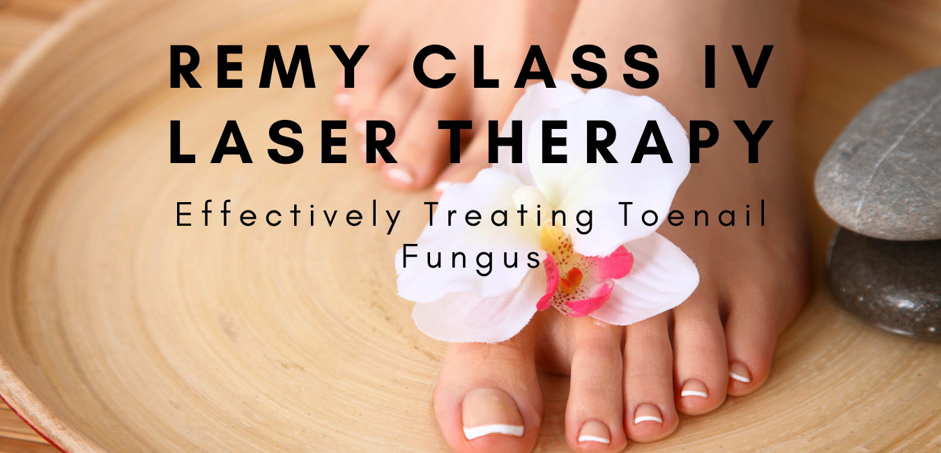 REMY LASER for fungus toenails