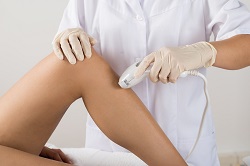 Laser Hair Removal in Torrance, CA 