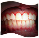 services_periodontal.jpg