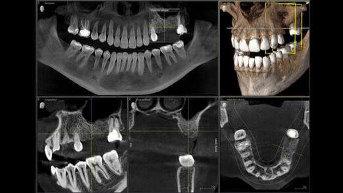 CBCT Images