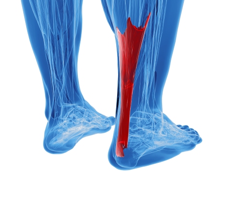 Achilles Tendonitis