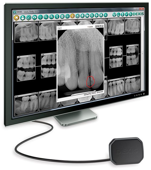 digital x ray 