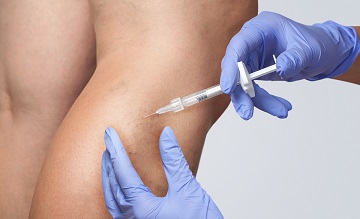 SCLEROTHERAPY & LASER VEIN THERAPY in Levittown, Long Beach, & Oceanside, NY