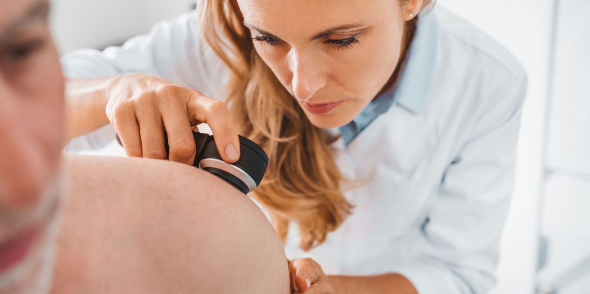 Skin Cancer in Tustin, CA