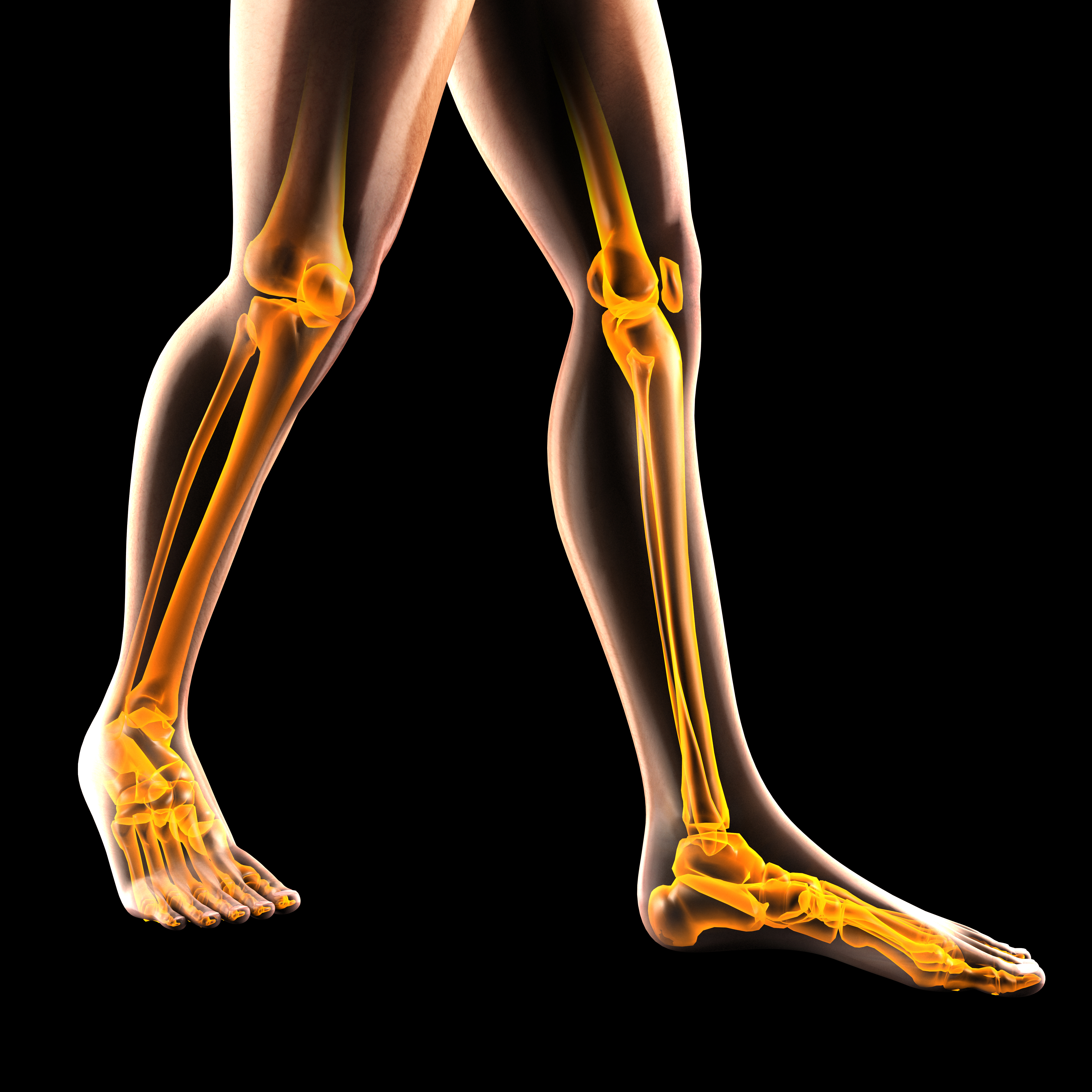 Human Leg radiography scan