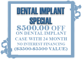 Dental Implants In East Brunswick, NJ | AC Dental