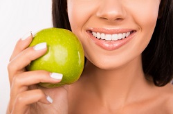 close up of woman's hand holding green apple next to her smiling mouth, cosmetic dentistry University City, MO