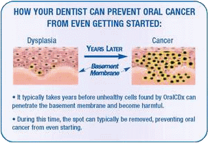 oralcdx_prevent(1)