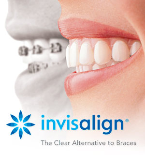 close up of mouth with metal braces on teeth next to mouth with clear aligners on teeth, Invisalign logo at bottom of image, Invisalign Asheville, NC dentist