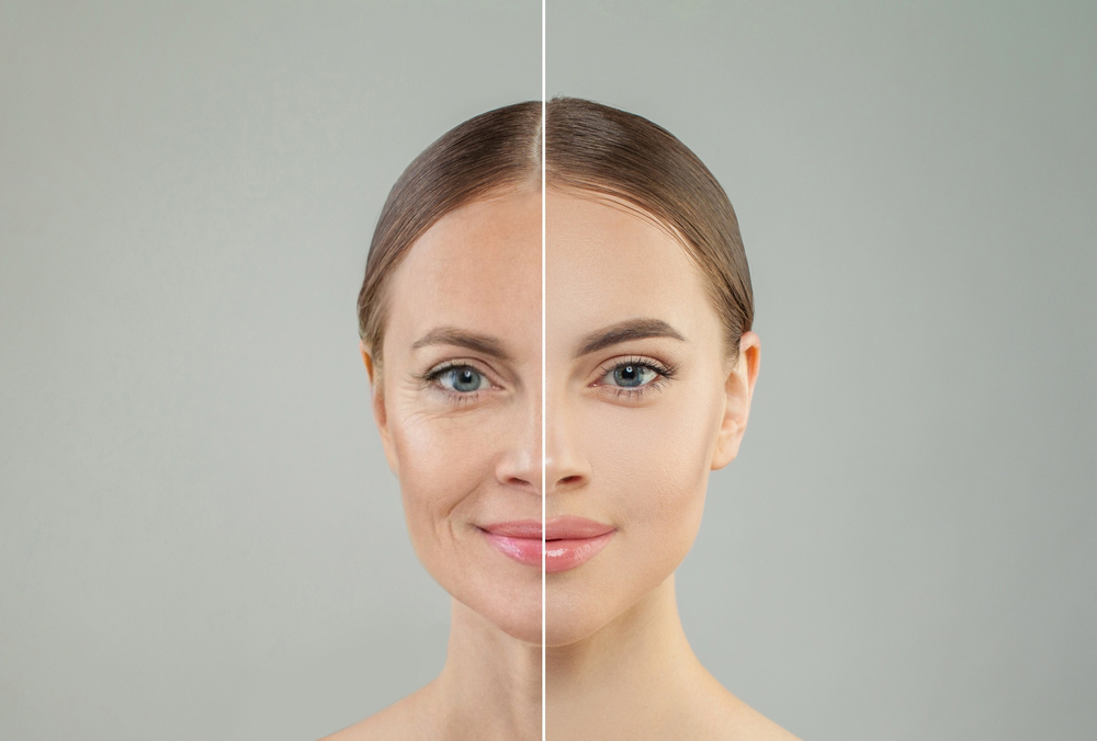 Before-and-After-Wrinkle-Treatment-in-Bend-OR