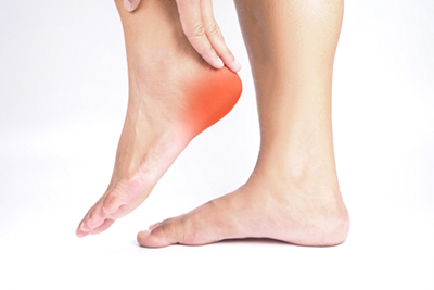 Plantar Fasciitis in Harrison & Mountain Home, AR