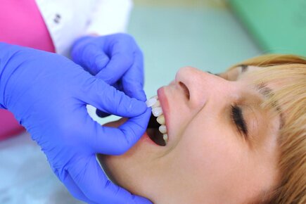 dentist placing veneer pieces on woman's front teeth, veneers Washington DC dentist