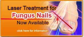 Laser Treatment For Fungus Nails