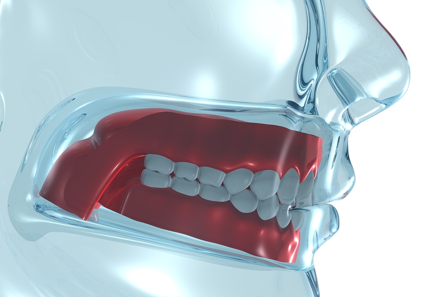 Dentures - Seymour, IN Dentist | Jackson County Dental