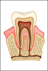 Mississauga Root Canal