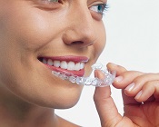 close up of women's face, smiling holding clear aligner tray near mouth, Invisalign dentist Adelaide SA, Cumberland Park dentist