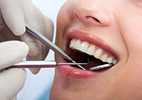 General Dentistry Decatur IL