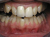 crown roselle dentist