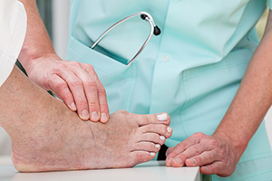 Bunion Treatment in Stamford CT