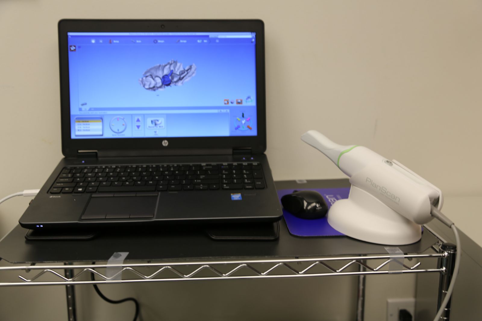 photo of the scanner and laptop and software we use scan and design crowns digitally