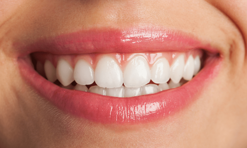 cosmetic bonding honolulu