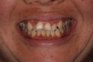 accelerated treatment honolulu hi