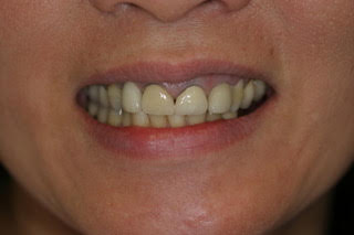 accelerated treatment honolulu