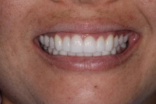 accelerated treatment in honolulu