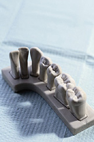 Dental Fillings Lincoln NE - Dentist