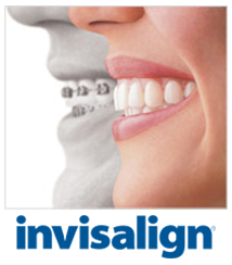 logo for Invisalign and images in background of mouth wearing braces next to mouth wearing clear aligners, Invisalign orthodontics Lawrenceville, GA dentist