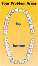 periodontal-disease-2