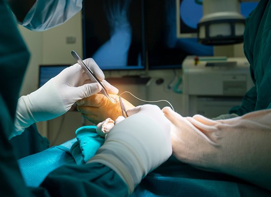 Foot-and-Ankle-Surgery-in-Fort-Dodge-IA