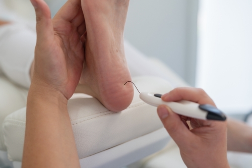 Podiatrist conducting a diabetic foot exam using a monofilament tool.