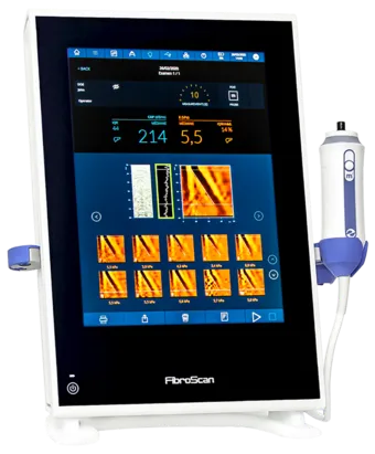 fibroscan