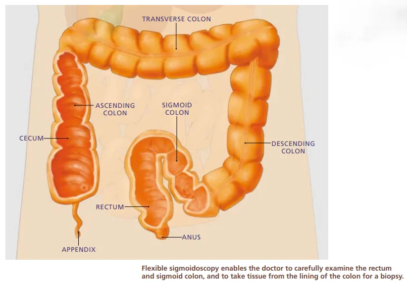 sigmoidoscopy